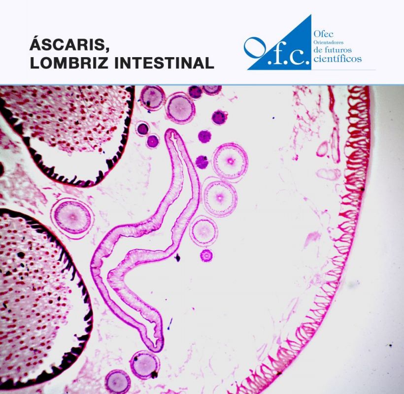 Áscaris, lombriz intestinal