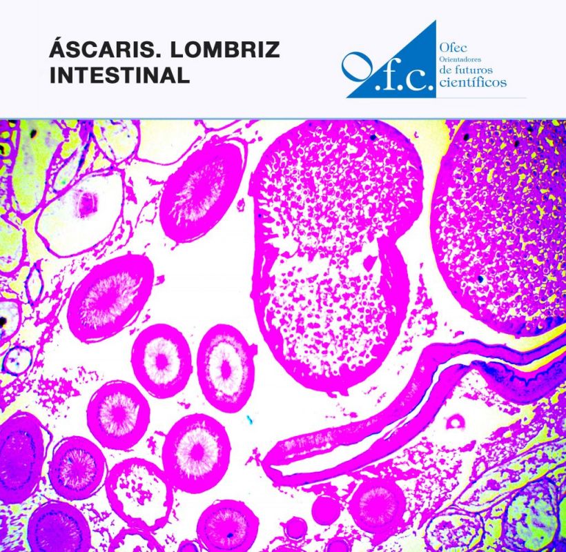 Áscaris. Lombriz intestinal