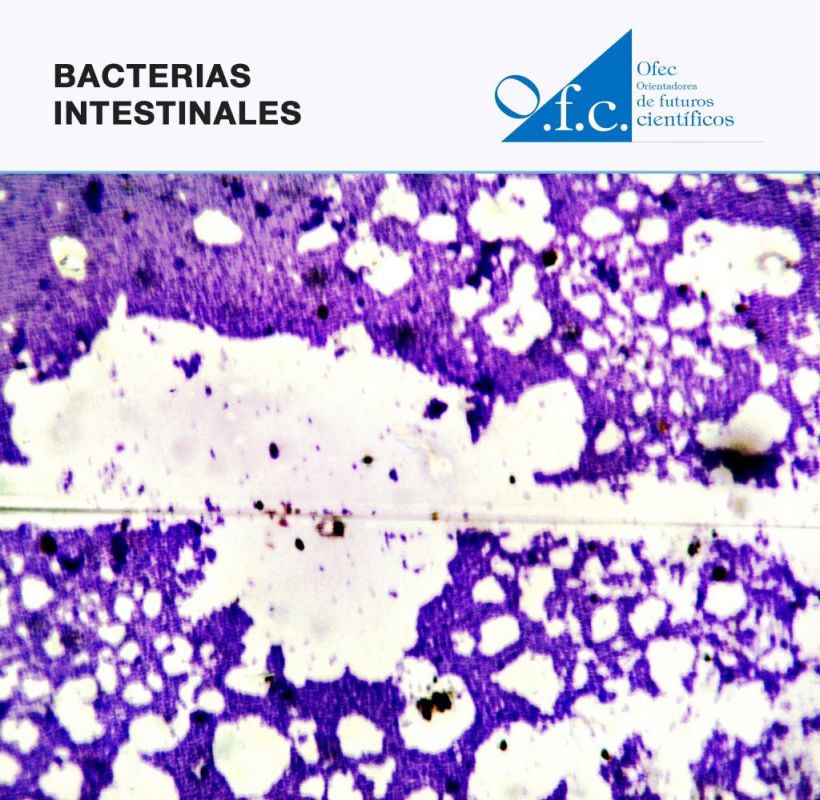 Bacterias intestinales