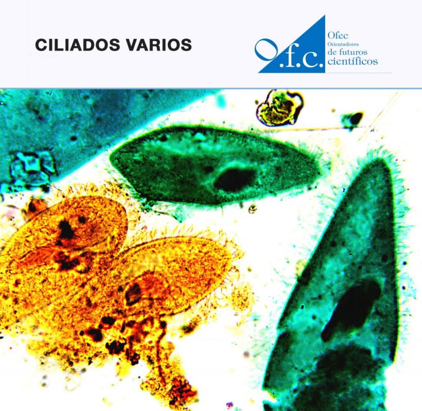 Ciliados varios