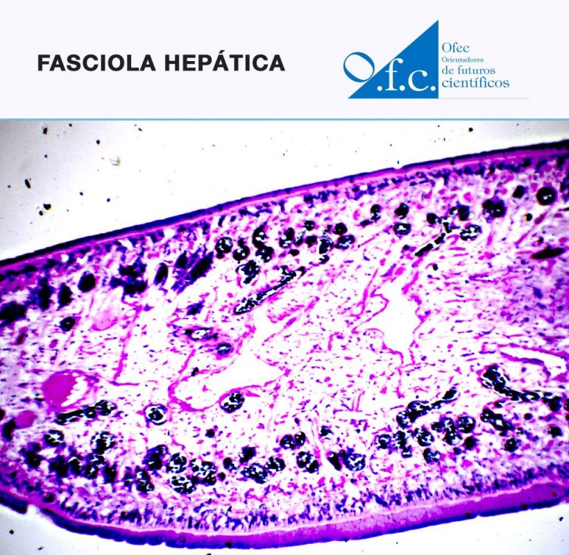 Fasciola hepática