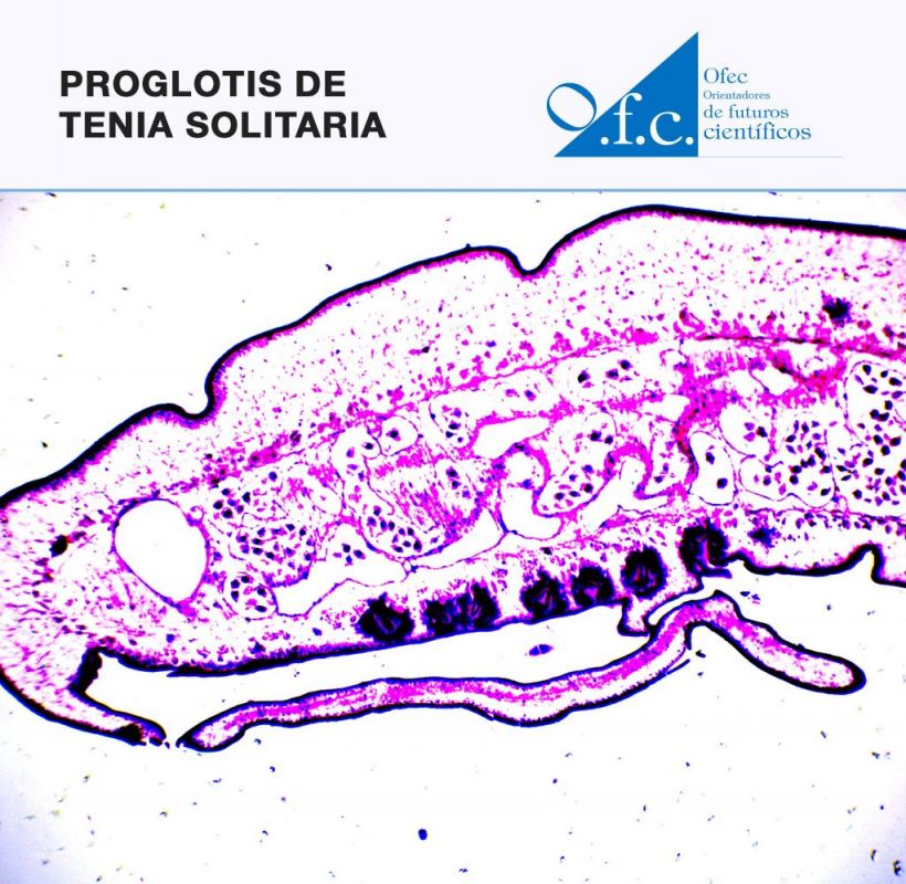 Proglotis de tenia solitaria